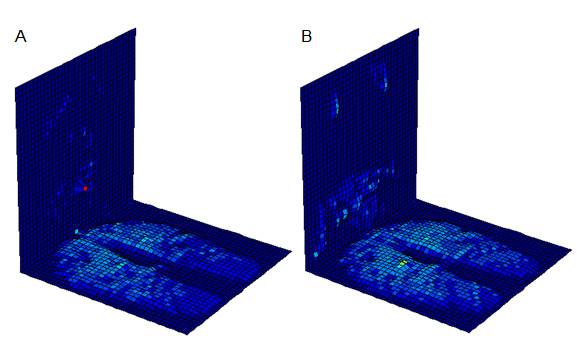 Pressure readings from the back
